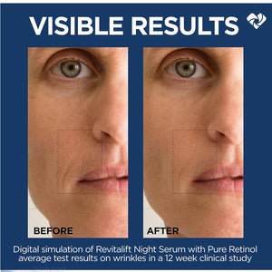 L'Oreal Paris Revitalift 0.3% Pure Retinol Night Serum, Reduce Deep Wrinkles, Fragrance Free 1 Oz + Moisturizer Sample