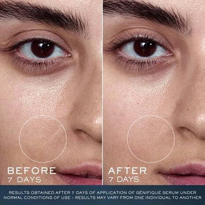 Lancôme Advanced Génifique Limited Edition Skincare Set - Full Size Serum 1.0 Fl Oz, Full Size Night Cream 1.7 Fl Oz & Full Size Cleanser 4.2 Fl Oz