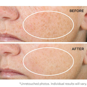 Strivectin Super C Retinol Brighten & Correct Vitamin C Serum & TL Neck Cream PLUS