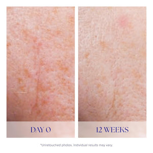 Is CLINICAL Active Serum - Visibly Evens Skin Tone, Excellent for Blemish Prone Skin, Anti-Aging Face Serum