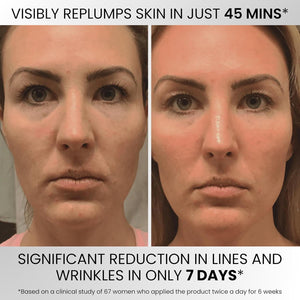 OMI Natural- Korean Premium Serum. 2% Hyaluronic Acid, 10% Niacinamide, 15% Vitamin C, 5% Hexapeptides. anti Aging, Hydrating, anti Wrinkle, Antioxidant, Dark Spot Reducer for Face. 1.69 Fl Oz/ 50Ml