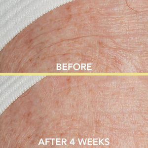 Lancer Skincare Triple Peptide Drops with Vitamin E, Daily Anti-Aging Face Serum with Hydrating Hyaluronic Acid, 1 Fluid Ounce