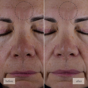 Philosophy Hope in a Jar Smooth-Glow Multi-Tasking Face Moisturizer - with Pro-Vitamin P, Glycolic Acid & Hyaluronic Acid - Provides Deep & Long-Lasting Hydration & Smoother, Radiant Skin 