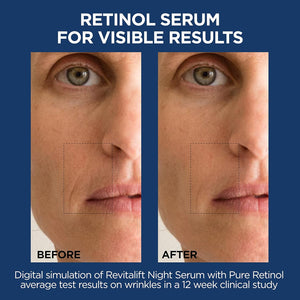 L'Oreal Paris Revitalift 1.5% Pure Hyaluronic Acid Face Serum + 0.3% Pure Retinol Night Serum, 1 Kit