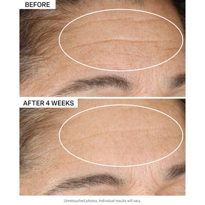 Strivectin Advanced Retinol Discovery Kit with Retinol Night Moisturizer, 1 Oz & Multi Correct Eye Cream 0.5 Oz, 2 Piece Kit for Wrinkles and Fine Lines 