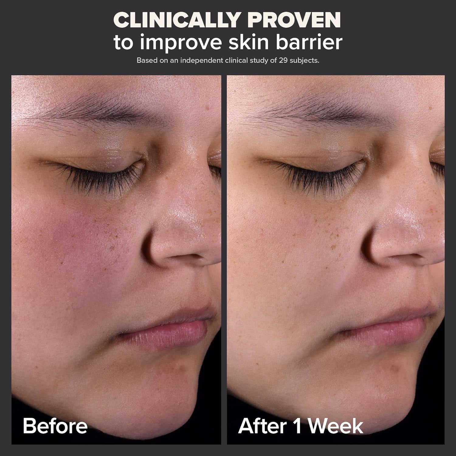 Paula'S Choice Skin Perfecting 2% BHA Liquid Salicylic Acid Exfoliant, Gentle Facial Exfoliator for Blackheads, Large Pores, Wrinkles & Fine Lines, Travel Size, 1 Fluid Ounce 