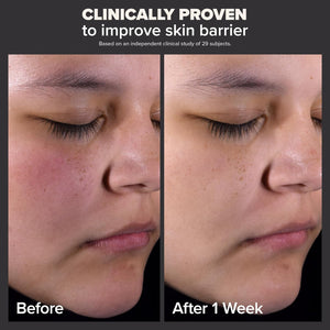 Paula'S Choice Skin Perfecting 2% BHA Liquid Salicylic Acid Exfoliant, Gentle Facial Exfoliator for Blackheads, Large Pores, Wrinkles & Fine Lines, Travel Size, 1 Fluid Ounce 