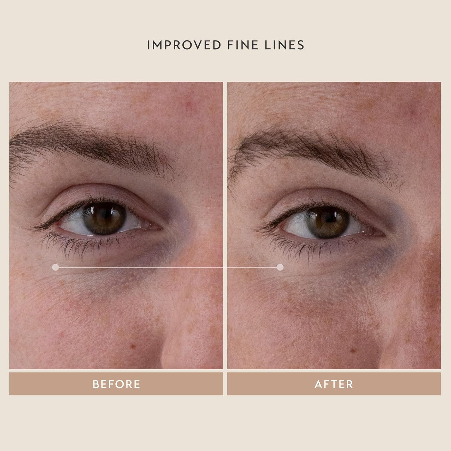 SHANI DARDEN SKINCARE Retinol Reform Anti-Aging Serum Travel Size, Resurfacing Retinol Serum for Face and Neck, Helps with Fine Lines and Wrinkles, 0.34 Fl Oz