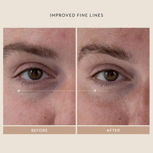 SHANI DARDEN SKINCARE Retinol Reform Anti-Aging Serum Travel Size, Resurfacing Retinol Serum for Face and Neck, Helps with Fine Lines and Wrinkles, 0.34 Fl Oz