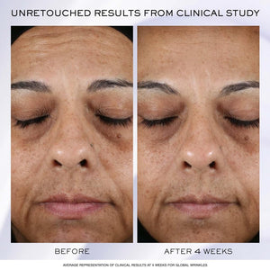 Lancôme Rénergie H.P.N 300-Peptide Face Cream - with Hyaluronic Acid & Niacinamide - Helps Visibly Reduce Lower Face Sagging, Wrinkles, & Dark Spots 