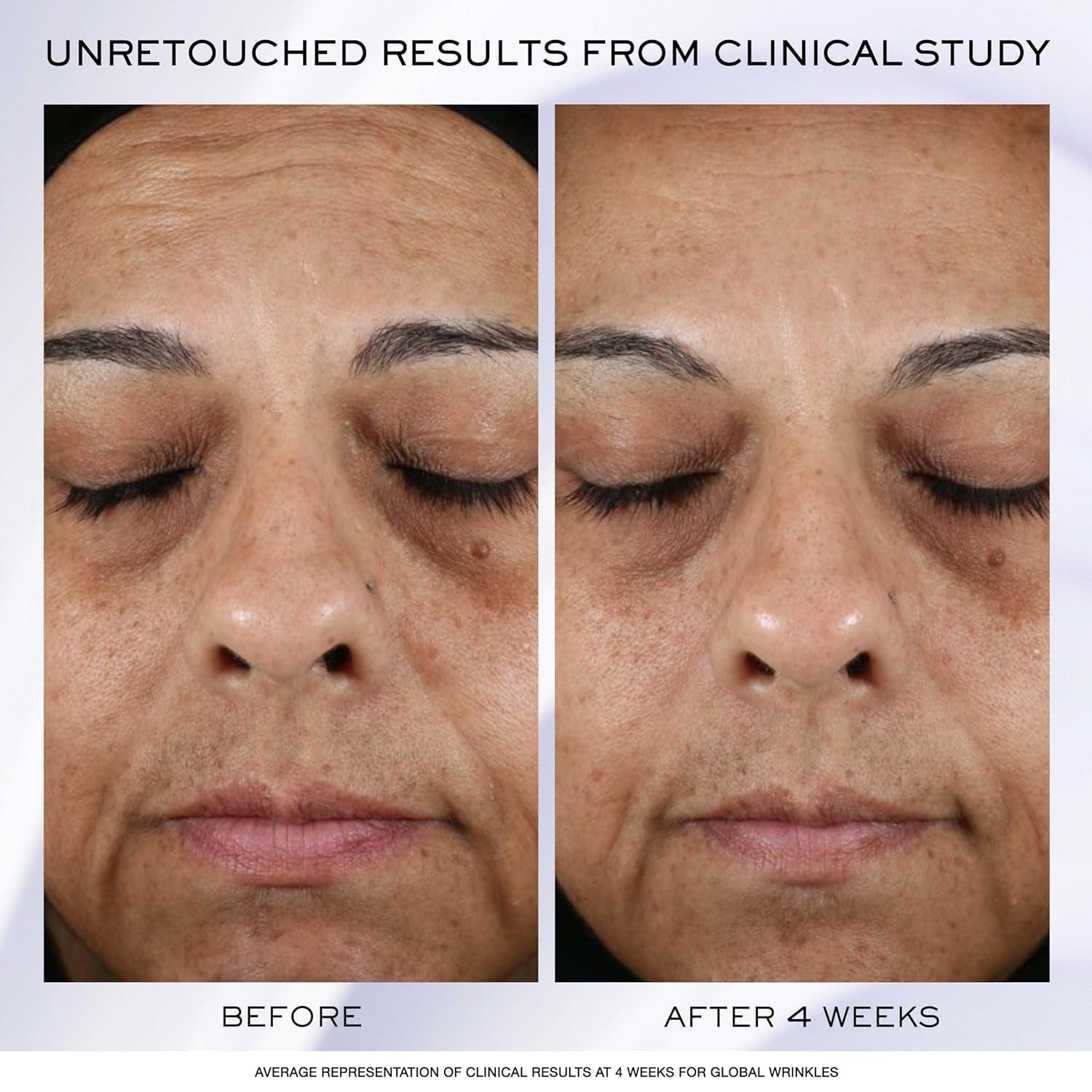 Lancôme​ Rénergie H.P.N 300-Peptide Face Cream - with Hyaluronic Acid & Niacinamide - Helps Visibly Reduce Lower Face Sagging, Wrinkles, & Dark Spots