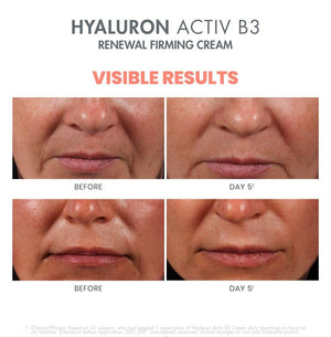 Eau Thermale Avene Hyaluron Activ B3 Renewal Firming Cream