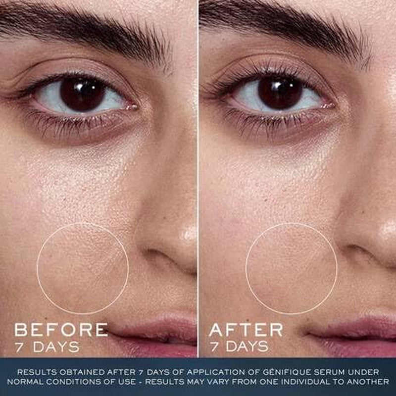 Lancôme Advanced Génifique Limited Edition Skincare Set - Full Size Serum 1.0 Fl Oz, Full Size Night Cream 1.7 Fl Oz & Full Size Cleanser 4.2 Fl Oz 