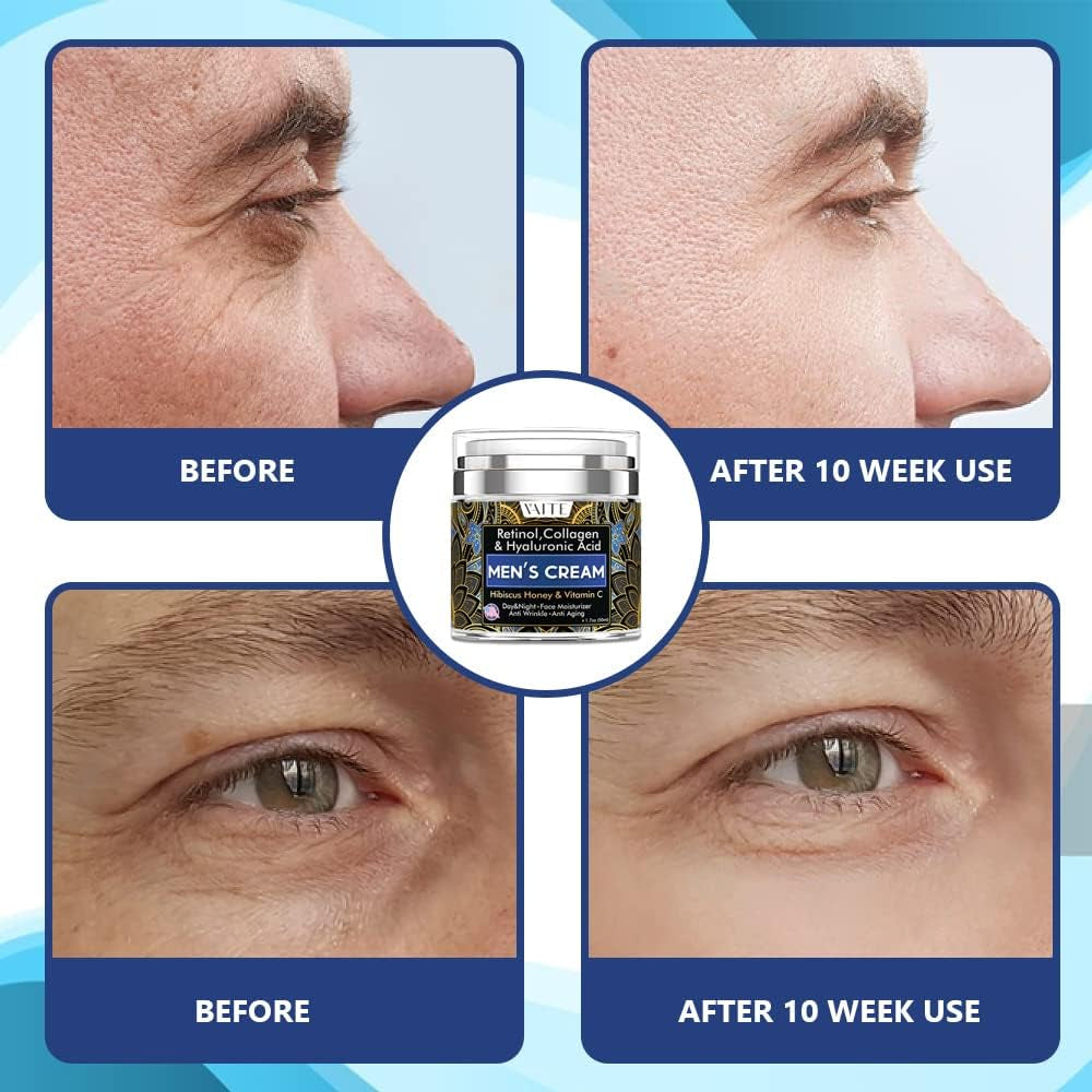 Under Eye Cream with Collagen, Retinol, Caffeine, Avacado Hyaluronic Acid & Hibiscus Honey for Night and Day with Vitamin B5, E for Puffiness Circles anti Aging Eye Bags and anti Wrinkle