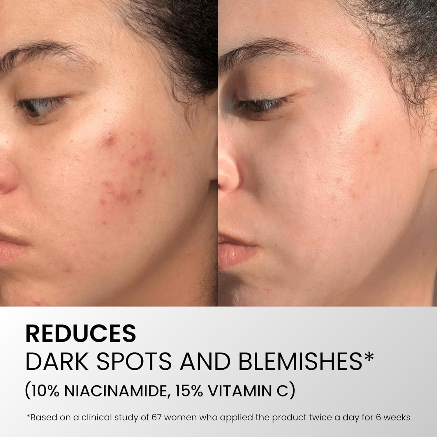 OMI Natural- Korean Premium Serum. 2% Hyaluronic Acid, 10% Niacinamide, 15% Vitamin C, 5% Hexapeptides. anti Aging, Hydrating, anti Wrinkle, Antioxidant, Dark Spot Reducer for Face. 1.69 Fl Oz/ 50Ml