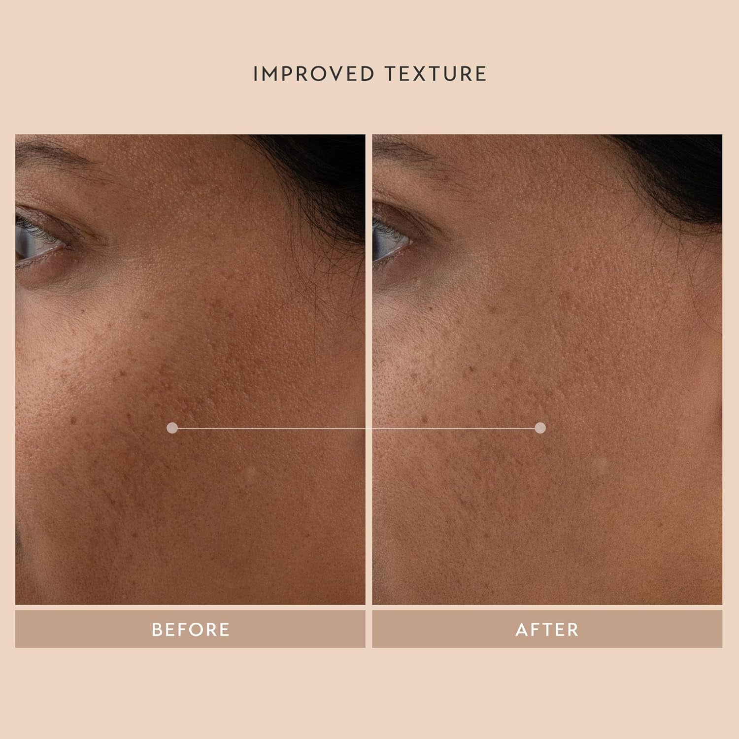 SHANI DARDEN SKINCARE Retinol Reform Anti-Aging Serum Travel Size, Resurfacing Retinol Serum for Face and Neck, Helps with Fine Lines and Wrinkles, 0.34 Fl Oz