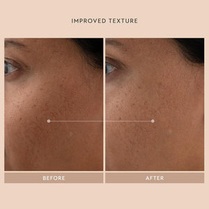 SHANI DARDEN SKINCARE Retinol Reform Anti-Aging Serum Travel Size, Resurfacing Retinol Serum for Face and Neck, Helps with Fine Lines and Wrinkles, 0.34 Fl Oz