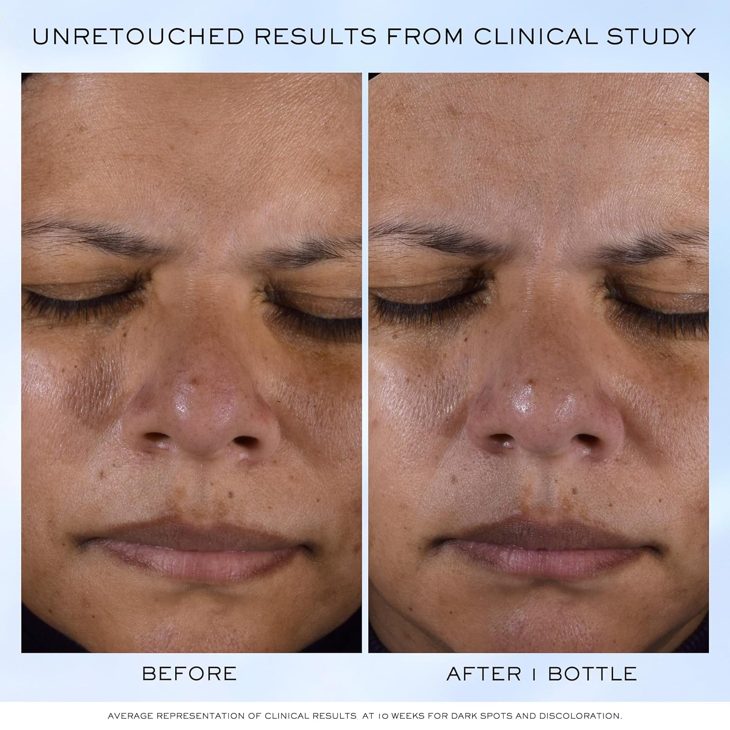 Lancôme Clarifique Pro-Solution Face Serum - Facial Serum for Visibly Reducing Dark Spots & Acne Spots - with 10% PHA and Niacinamide - 1.0 Fl Oz 