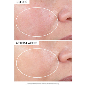 Strivectin Advanced Retinol Discovery Kit with Retinol Night Moisturizer, 1 Oz & Multi Correct Eye Cream 0.5 Oz, 2 Piece Kit for Wrinkles and Fine Lines 