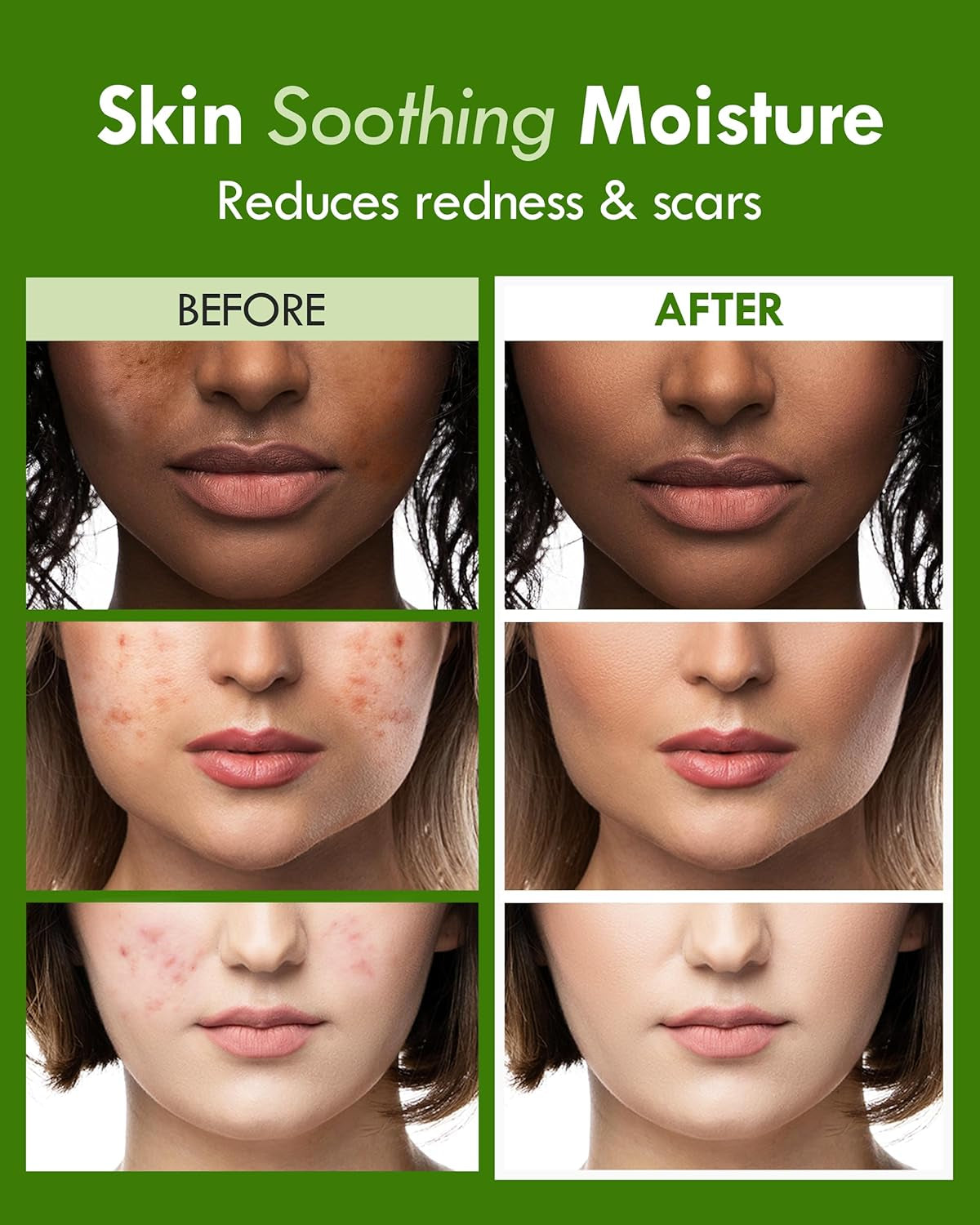 LABIOTTE Mydeca Cica Gel Serum Mist | Face Serum Spray Gel Moisturizer W/Centella Asiatica | Korean Skincare Hydrating Face Mist | Centella Moisturizer Glow Serum Facial Spray (Pack of 1, 3.21 Fl Oz)