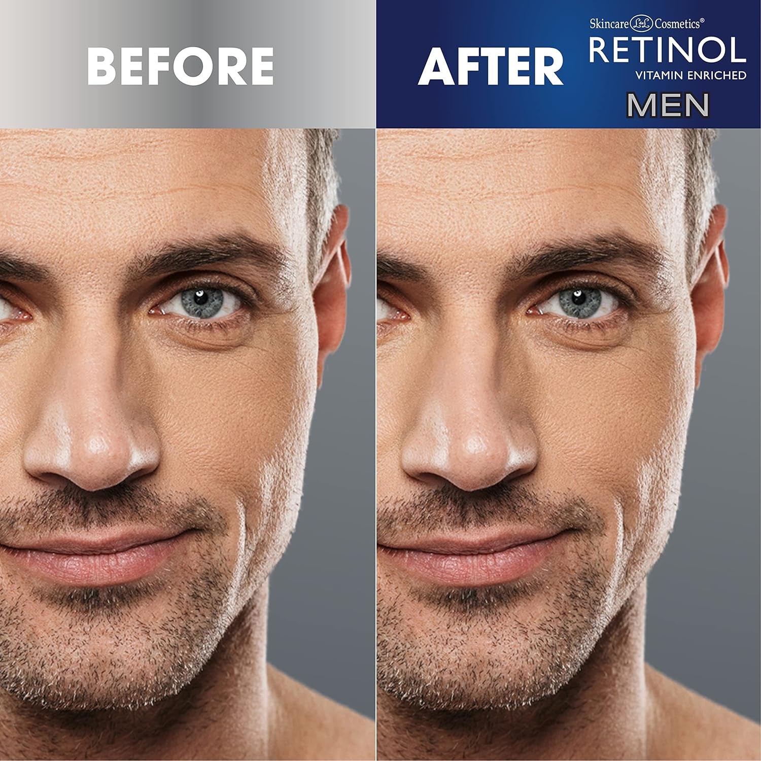 Retinol Men’S Anti-Wrinkle Facial Serum – the Original Retinol Anti-Aging Men’S Formula for Younger Looking Skin – Vitamin-Enriched to Smooth Fine Lines & Wrinkles, Improve Tone & Promote Firmness 