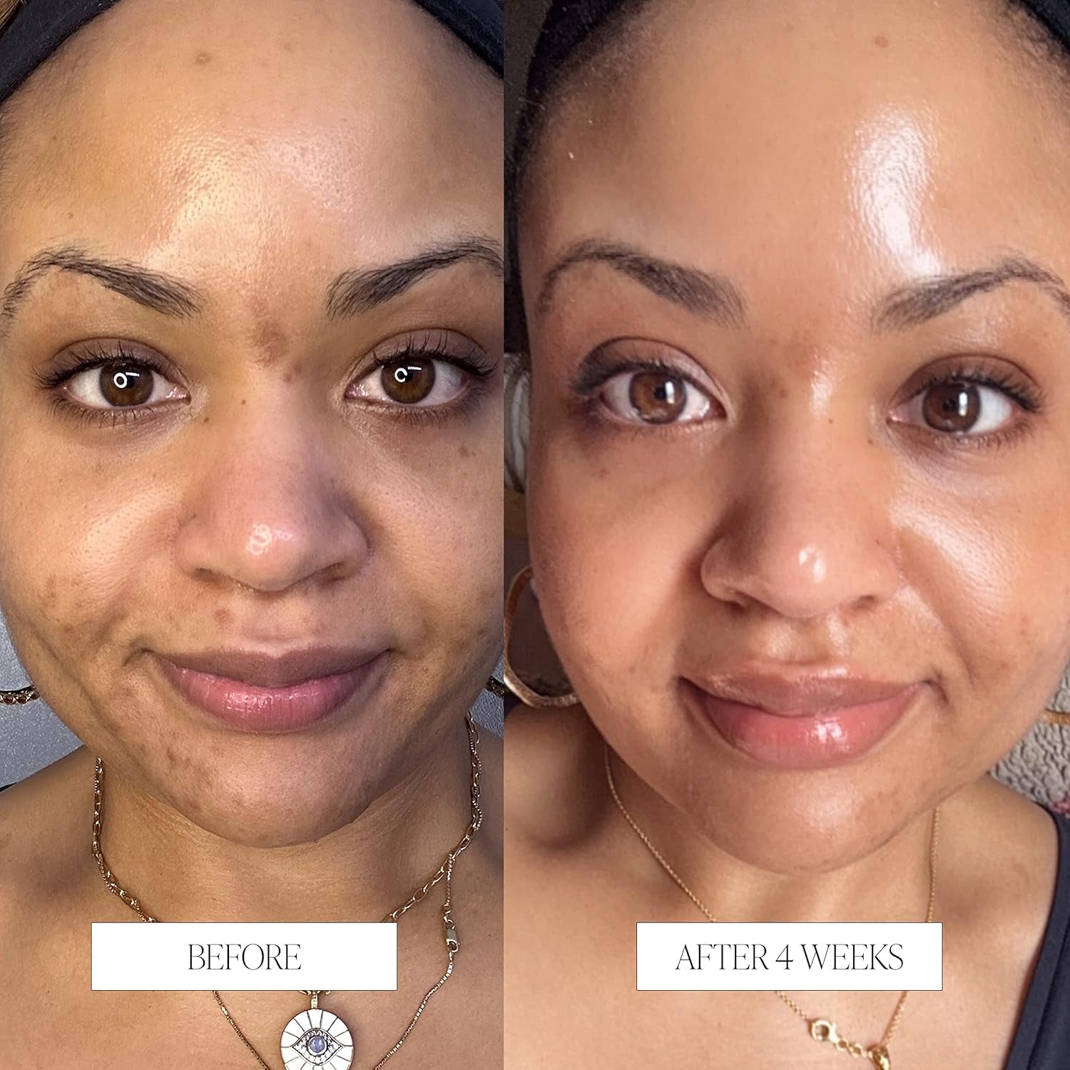 Byroe Exfoliating AHA Serum | Gentle Celery Serum for Resurfacing and Acne Prone Skin | Clarifying Pore Minimizer with Vitamin 12 Complex and LHA from Salicylic Acid | Vegan 30 ML