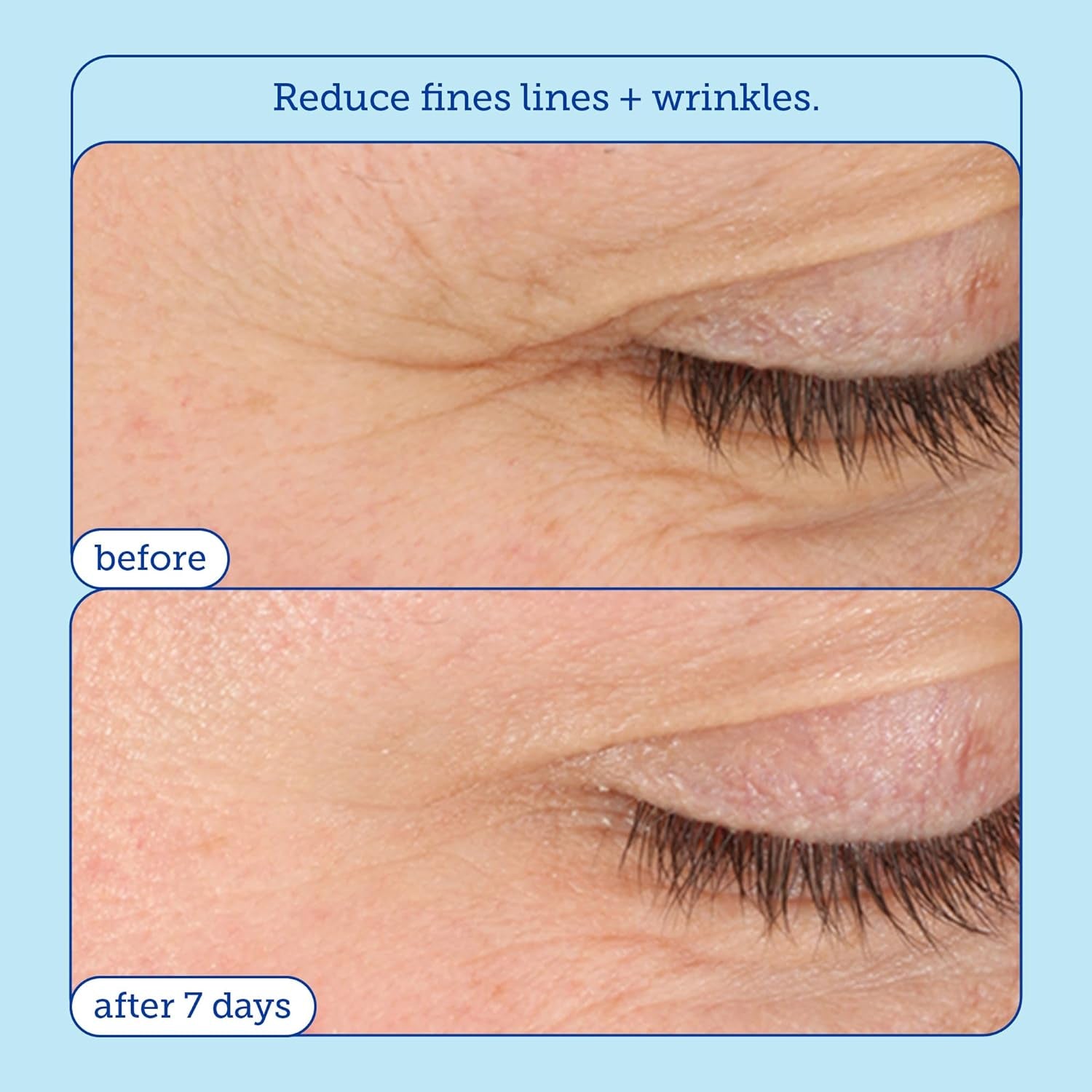 Skinfix Barrier+ Triple Lipid-Boost 360° Eye Cream: Targets Dark Circles, Puffiness, and Fine Lines around Eyes and Lids, Clinically Proven to Brighten and Refresh Eyes, 0.5 Oz