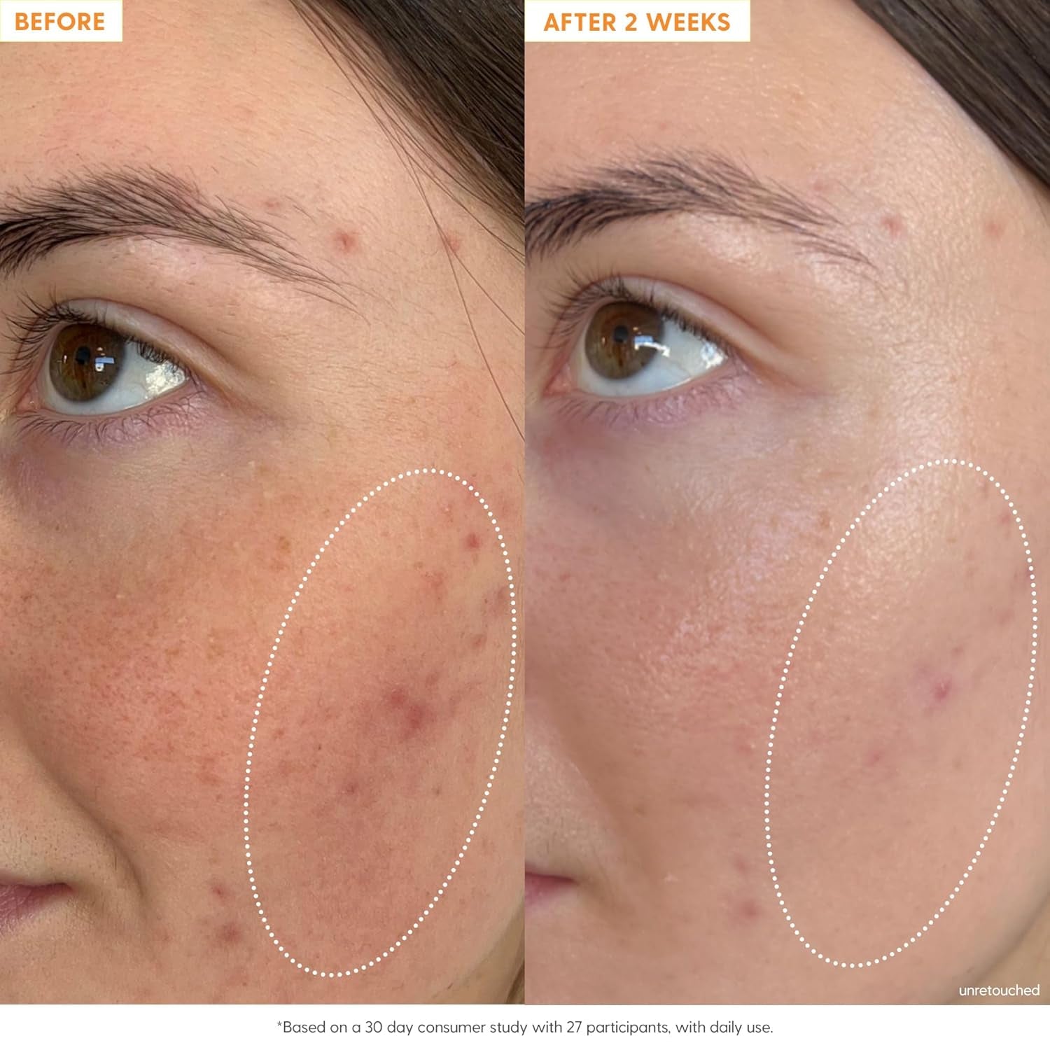 Kinship Self Smooth 10% Glycolic Pore Minimizing Toner-Serum - Exfoliating Glycolic Acid - Overnight Resurfacing Treatment - Brighten, Smooth, Hydrate - AHA + Vitamin C Facial Toner (2.2 Fl Oz)