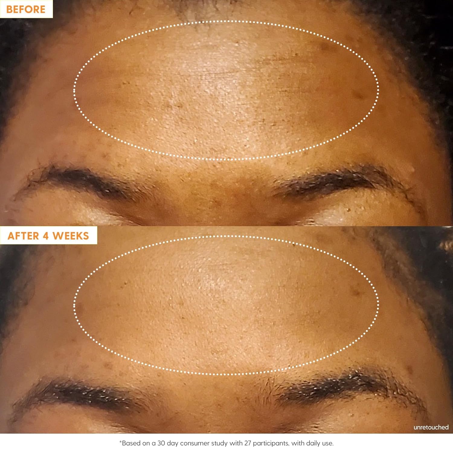 Kinship Self Smooth 10% Glycolic Pore Minimizing Toner-Serum - Exfoliating Glycolic Acid - Overnight Resurfacing Treatment - Brighten, Smooth, Hydrate - AHA + Vitamin C Facial Toner (2.2 Fl Oz)