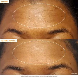 Kinship Self Smooth 10% Glycolic Pore Minimizing Toner-Serum - Exfoliating Glycolic Acid - Overnight Resurfacing Treatment - Brighten, Smooth, Hydrate - AHA + Vitamin C Facial Toner (2.2 Fl Oz)