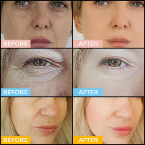 Retinol Serum for Face 2.5%, B5 Herbal Resurfacing Retinol Serum with Vitamin C, Vitamin E, Hyaluronic Acid, Serum for Anti-Aging, Wrinkle Smoothing, Dark Spot Corrector, Brighten Dullness 2 Packs