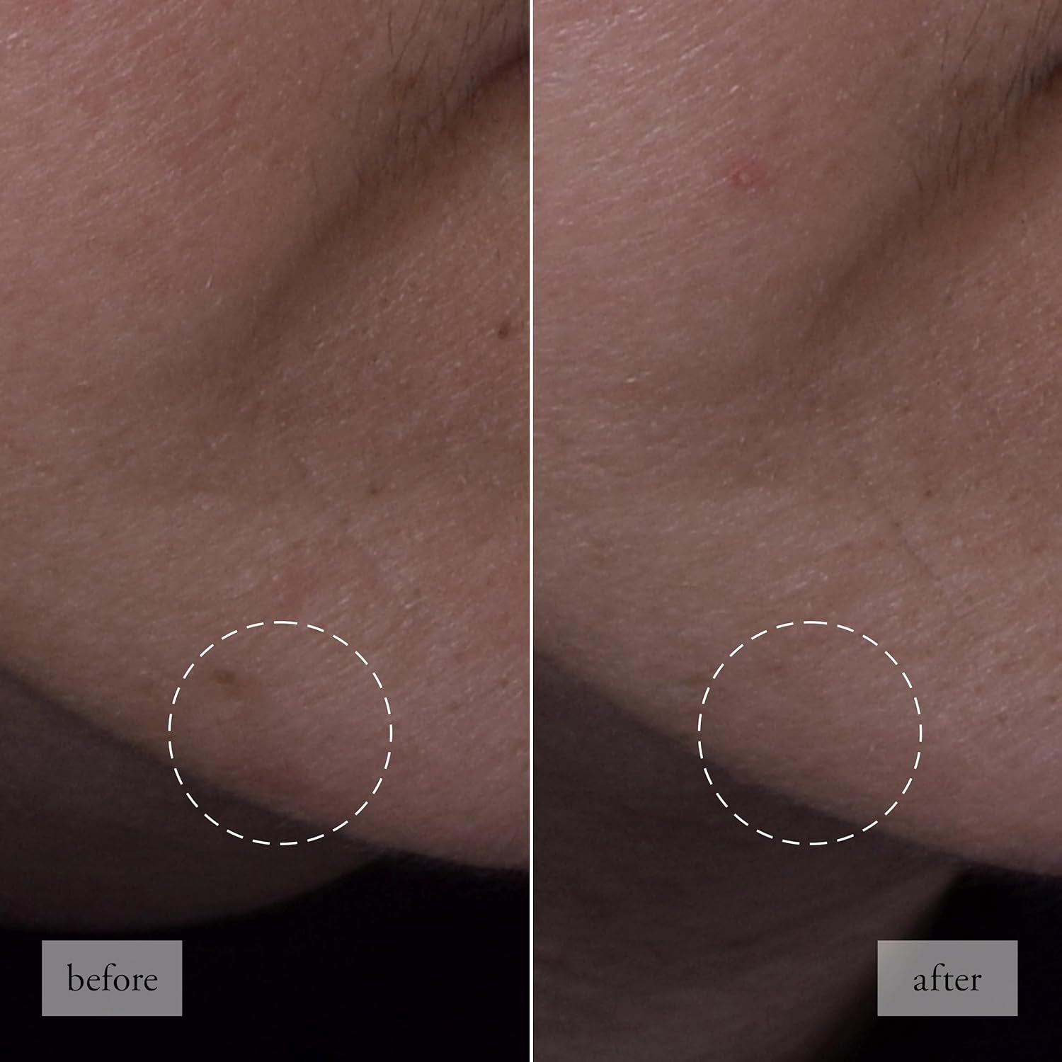 Philosophy Hope in a Jar Smooth-Glow Multi-Tasking Face Moisturizer - with Pro-Vitamin P, Glycolic Acid & Hyaluronic Acid - Provides Deep & Long-Lasting Hydration & Smoother, Radiant Skin 